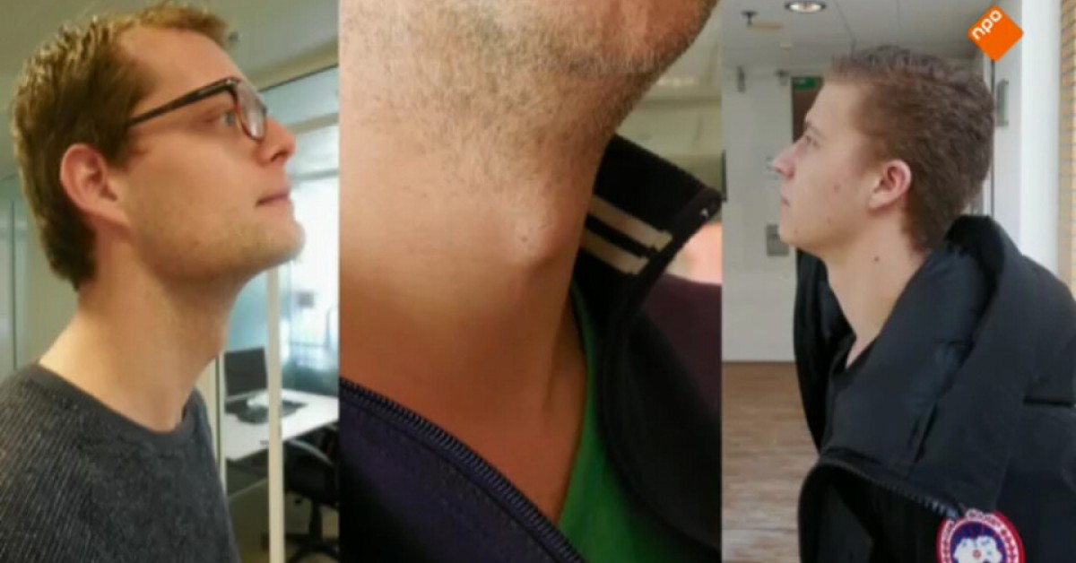 Wat gebeurt er als je de baard in de keel krijgt? Willem Wever Wat gebeurt er als je de baard in de keel krijgt? Willem Wever